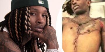 King Von Autopsy: Unveiling the Truth Behind His Tragic Death